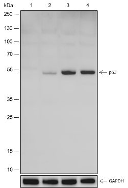 Anti-p53 Rabbit mAb