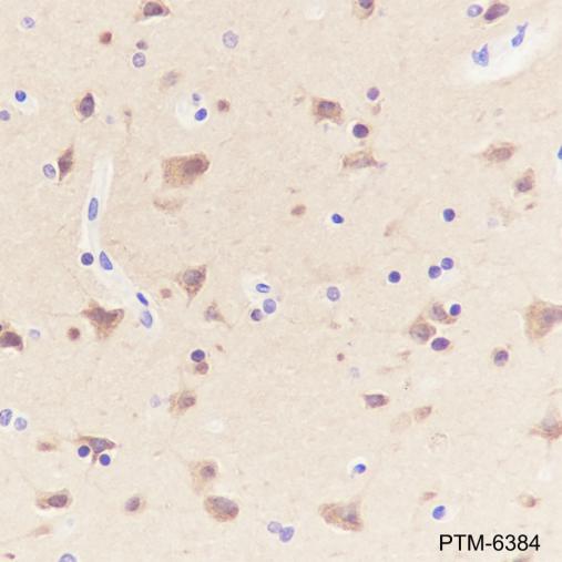 Anti-LC3B Rabbit mAb