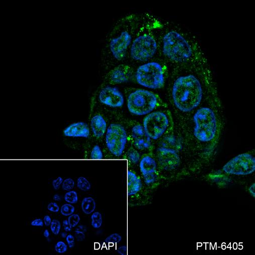 Anti-TPRKB Mouse mAb