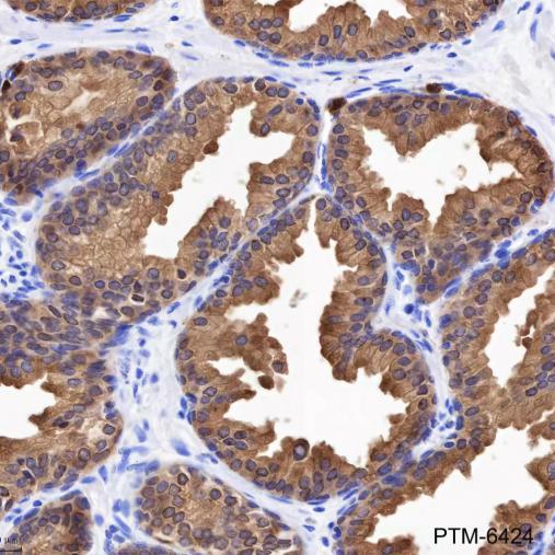 Anti-Annexin A3 Mouse mAb