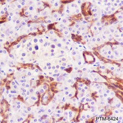 Anti-Annexin A3 Mouse mAb