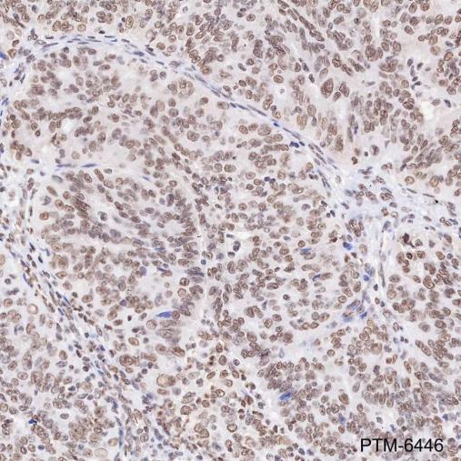 Anti-SSRP1 Mouse mAb