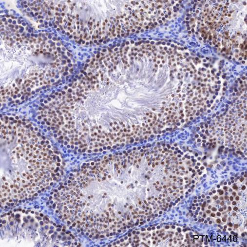 Anti-SSRP1 Mouse mAb