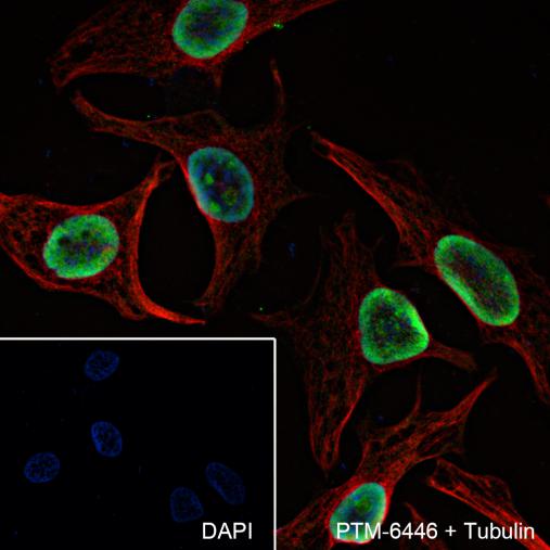 Anti-SSRP1 Mouse mAb