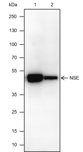 Anti-NSE Mouse mAb