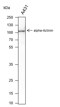 Anti-alpha Actinin 2 Mouse mAb