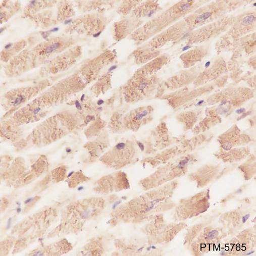 Anti-alpha Actinin 2 Mouse mAb