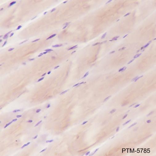 Anti-alpha Actinin 2 Mouse mAb