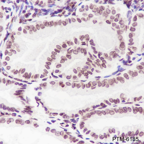 Anti-Phospho-Cyclin D1 (Thr286) Rabbit mAb