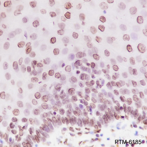 Anti-Phospho-Cyclin D1 (Thr286) Rabbit mAb