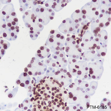 Anti-Phospho-Cyclin D1 (Thr286) Rabbit mAb