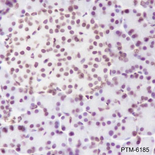 Anti-Phospho-Cyclin D1 (Thr286) Rabbit mAb