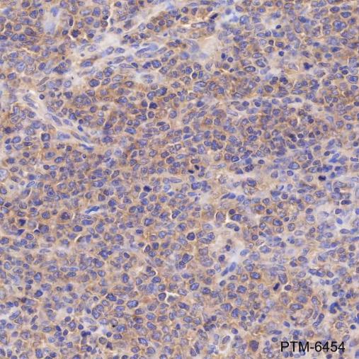 Anti-ROCK1 Mouse mAb