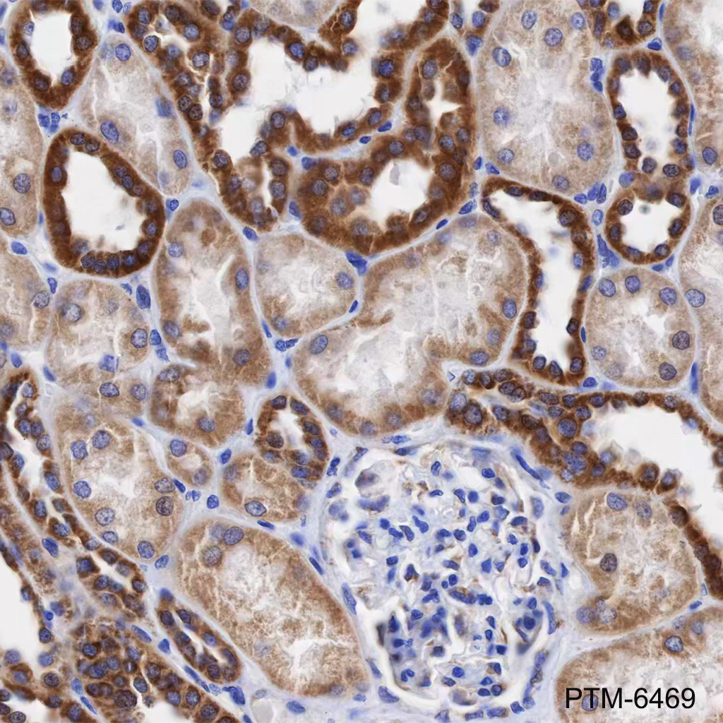 Anti-CHCHD6 Mouse mAb