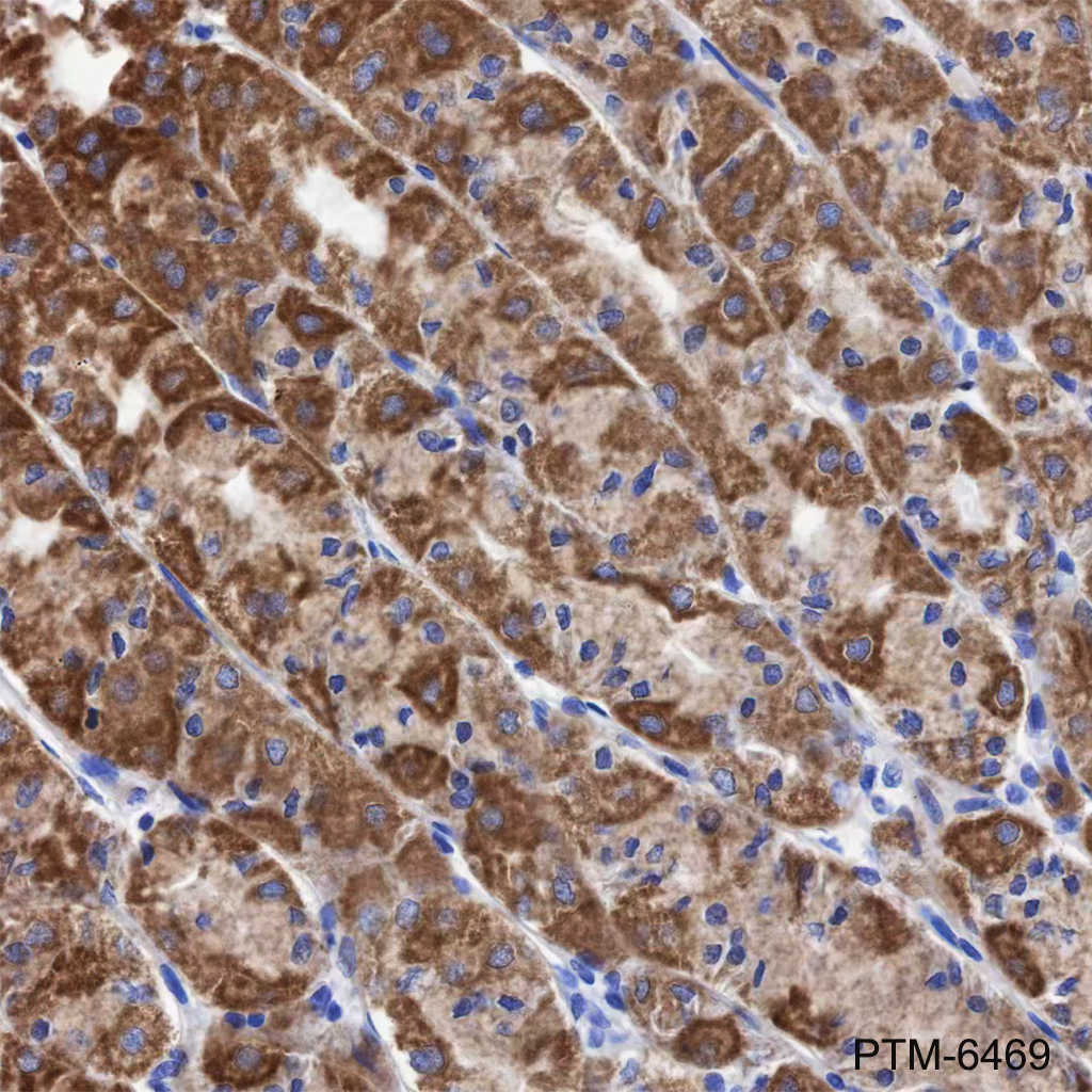 Anti-CHCHD6 Mouse mAb