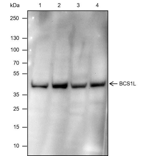 Anti-BCS1L Mouse mAb