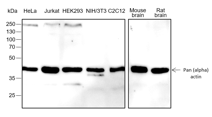Anti-Pan-Actin Rabbit mAb