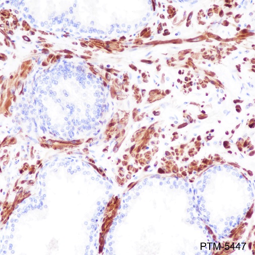 Anti-Pan-Actin Rabbit mAb