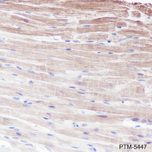 Anti-Pan-Actin Rabbit mAb