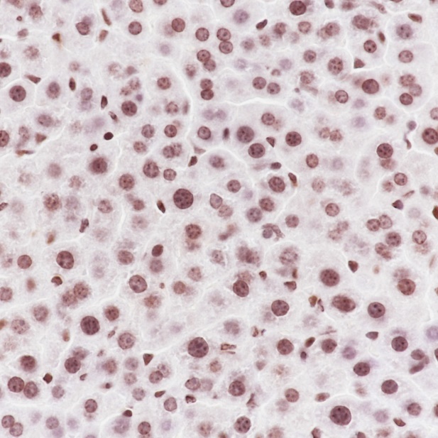 Anti-Malonyl-Histone H3 (Lys122) Rabbit mAb