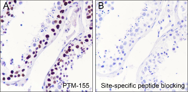 Anti-Acetyl-Histone H2B (Lys20) Mouse mAb