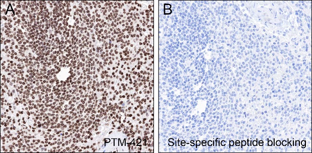 Anti-Succinyl-Histone H3 (Lys14) Mouse mAb