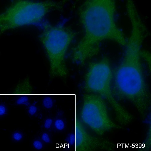 Anti-Clathrin Heavy Chain Mouse mAb