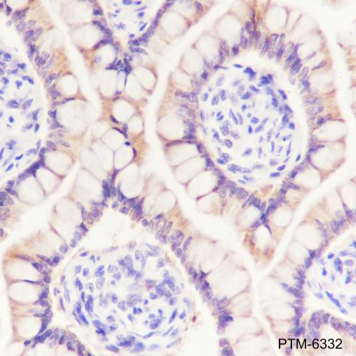 Anti-TIP47 Mouse mAb