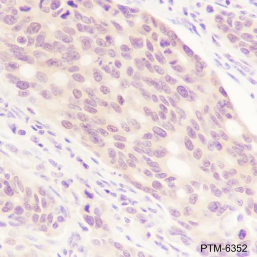 Anti-ADRM1 Mouse mAb