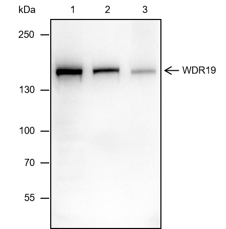 Anti-WDR19 Mouse mAb