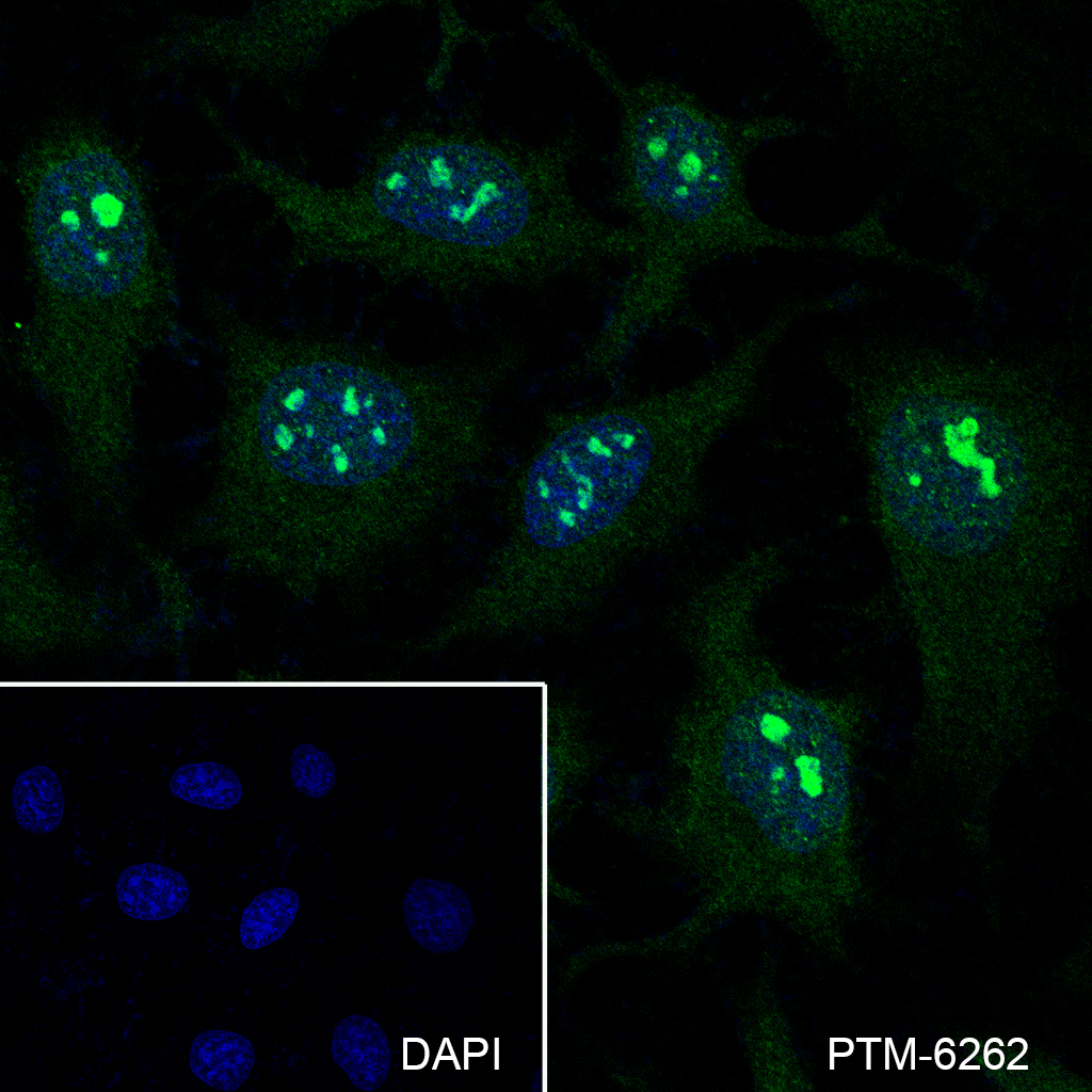 Anti-PPP1CA Mouse mAb