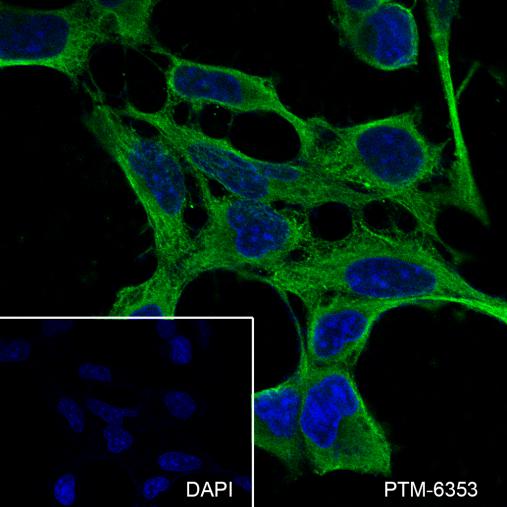Anti-DKK3 Mouse mAb