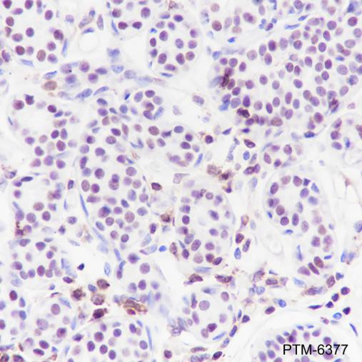Anti-CHD3 Rabbit mAb
