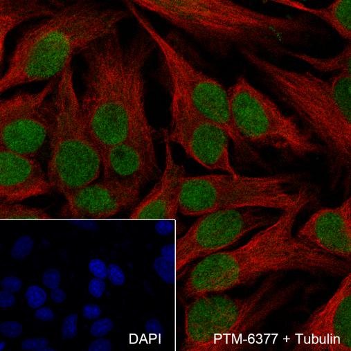 Anti-CHD3 Rabbit mAb