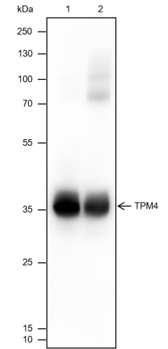 Anti-TPM4 Mouse mAb