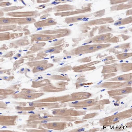 Anti-TPM4 Mouse mAb