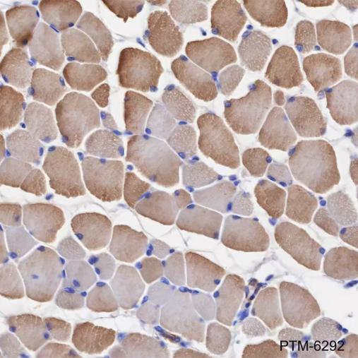 Anti-TPM4 Mouse mAb