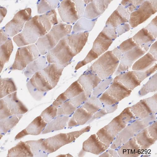 Anti-TPM4 Mouse mAb