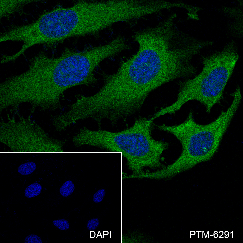 Anti-PKC alpha Rabbit mAb