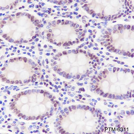 Anti-Transketolase Mouse mAb