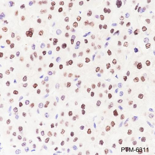 Anti-Transketolase Mouse mAb