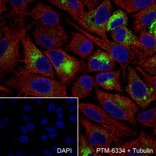 Anti-MUC5AC Mouse mAb