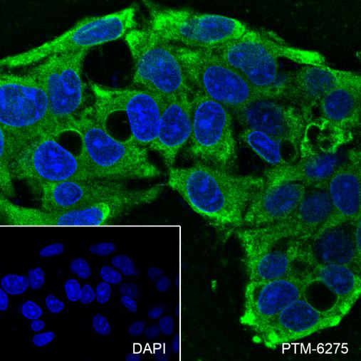 Anti-PGAM1 Mouse mAb