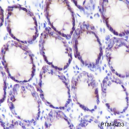 Anti-Caspase-6 Rabbit mAb