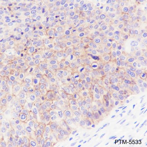 Anti-Na+/K+ ATPase alpha-1 Mouse mAb
