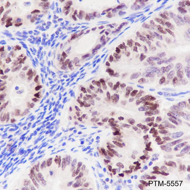 Anti-SMARCD3 Rabbit mAb