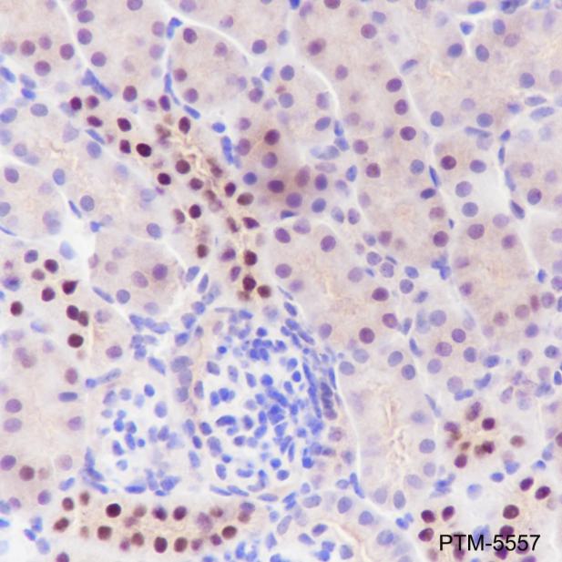 Anti-SMARCD3 Rabbit mAb