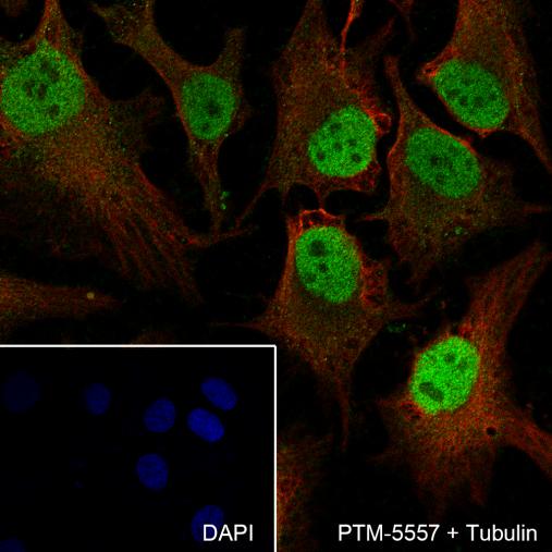 Anti-SMARCD3 Rabbit mAb