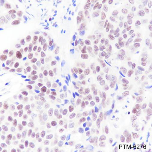 Anti-Chk2 Mouse mAb