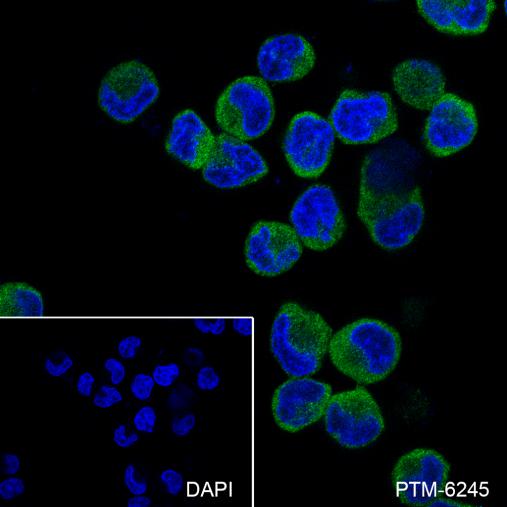 Anti-CTPS2 Mouse mAb